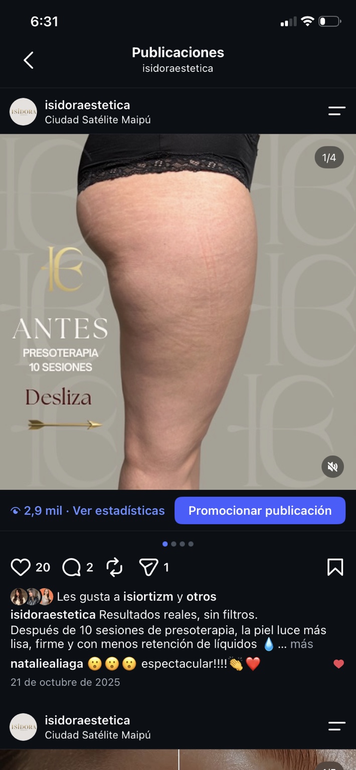 Antes de presoterapia, comparación 1.