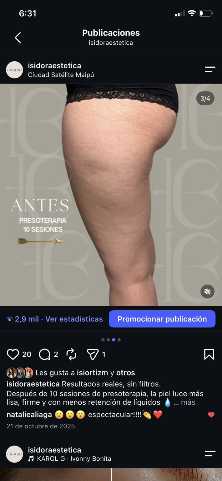 Antes de presoterapia, comparación 2.