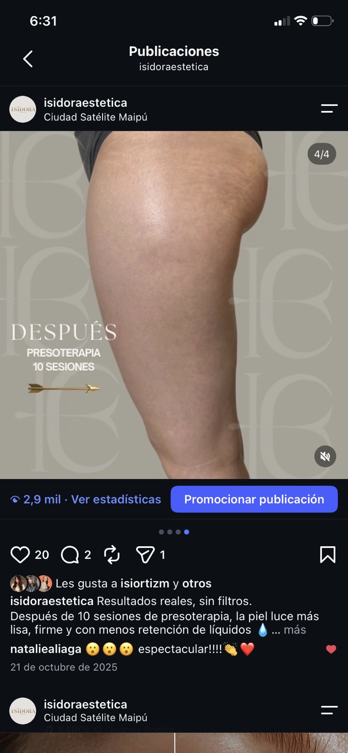 Después de 10 sesiones de presoterapia, comparación 2.