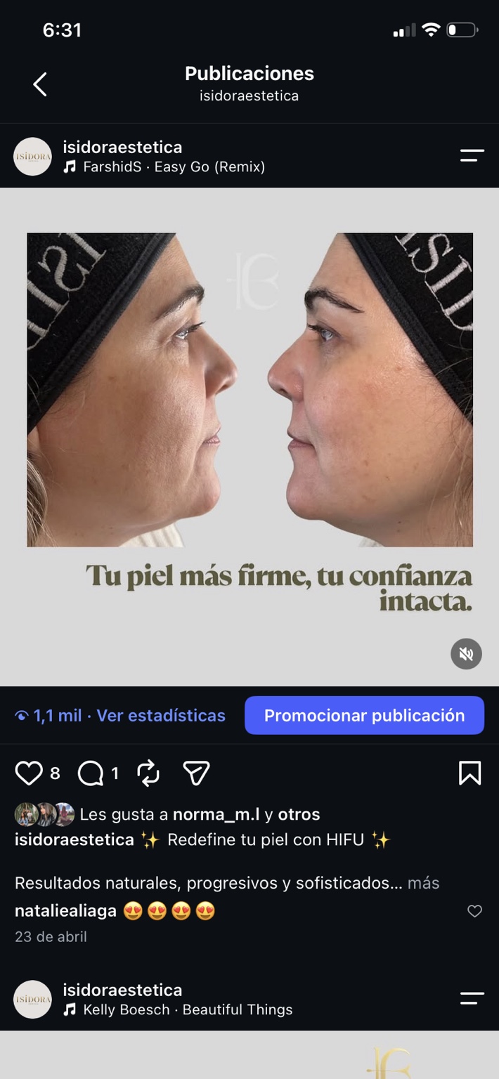 Registro comparativo de HIFU facial publicado por ISIDORA ESTÉTICA.